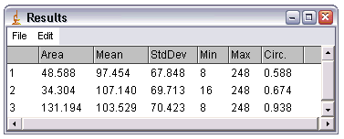 [Measurements]