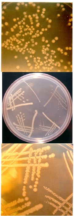 E. coli